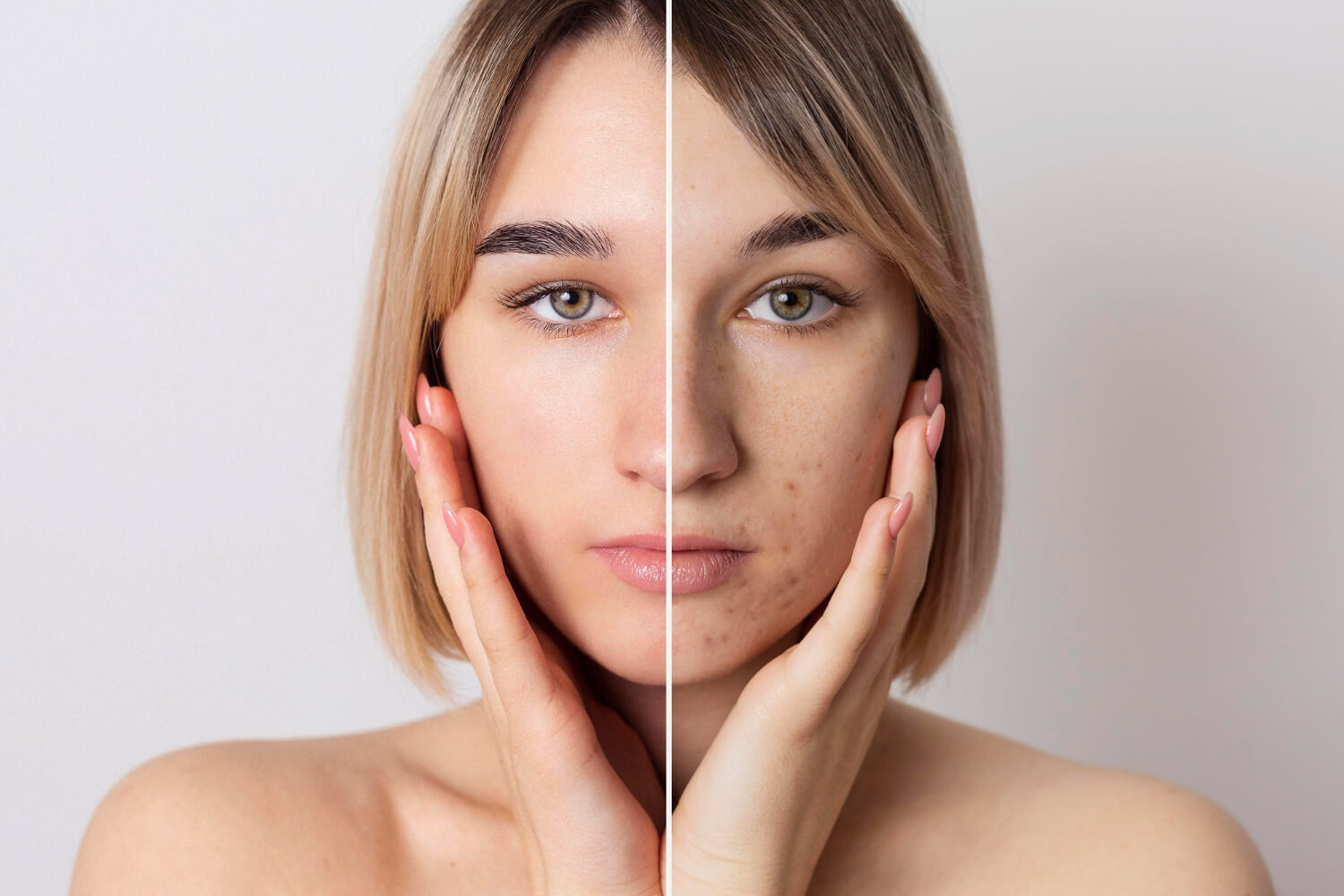 Inicio 12 Dermatología